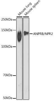 ANPRB/NRP2 Rabbit Monoclonal Antibody