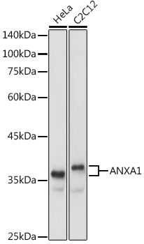 ANXA1 Rabbit Polyclonal Antibody