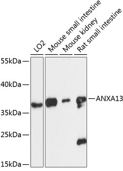 ANXA13 Rabbit Polyclonal Antibody