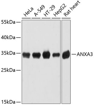 ANXA3 Rabbit Polyclonal Antibody