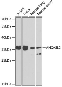 ANXA8L2 Rabbit Polyclonal Antibody