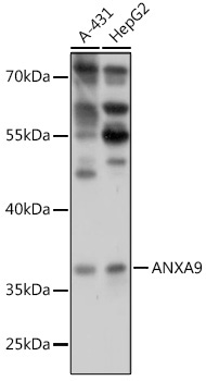 ANXA9 Rabbit Polyclonal Antibody