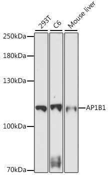 AP1B1 Rabbit Polyclonal Antibody