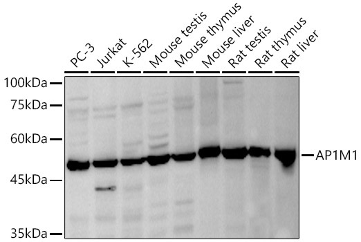 AP1M1 Rabbit Polyclonal Antibody