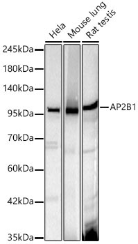 AP2B1 Rabbit Monoclonal Antibody