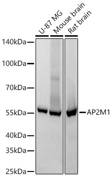 AP2M1 Rabbit Monoclonal Antibody