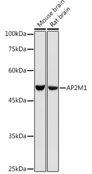 AP2M1 Rabbit Polyclonal Antibody