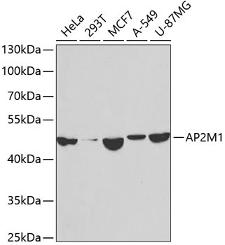 AP2M1 Rabbit Polyclonal Antibody
