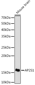 AP2S1 Rabbit Monoclonal Antibody