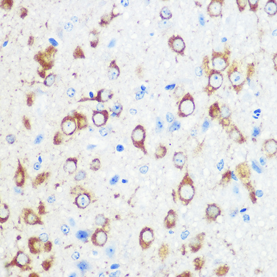 APBA1 Rabbit Polyclonal Antibody