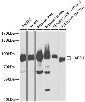 APEH Rabbit Polyclonal Antibody