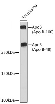 ApoB Rabbit Monoclonal Antibody