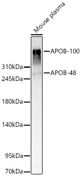 APOB Rabbit Polyclonal Antibody