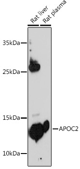 APOC2 Rabbit Polyclonal Antibody