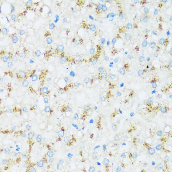 APOD Rabbit Polyclonal Antibody