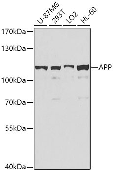 APP Rabbit Polyclonal Antibody