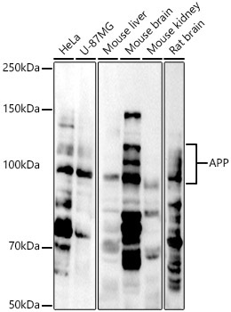 APP Rabbit Polyclonal Antibody