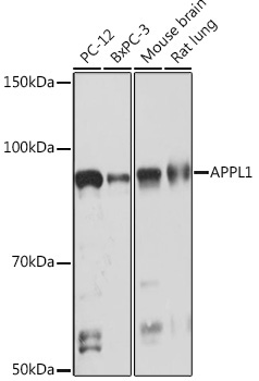 APPL1 Rabbit Monoclonal Antibody