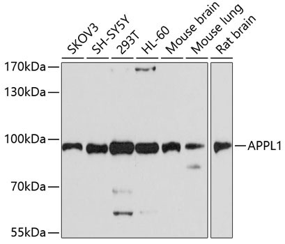 APPL1 Rabbit Polyclonal Antibody