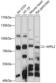 APPL2 Rabbit Polyclonal Antibody
