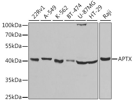APTX Rabbit Polyclonal Antibody