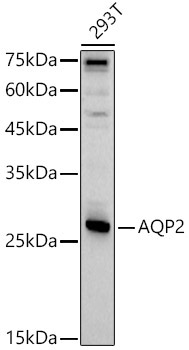 AQP2 Rabbit Polyclonal Antibody