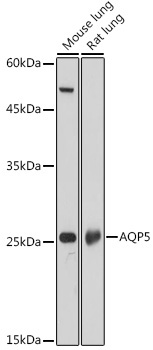 AQP5 Rabbit Polyclonal Antibody