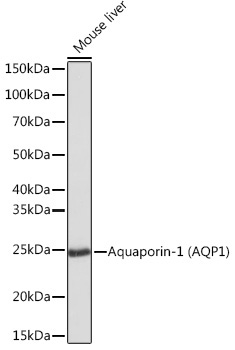 Aquaporin-1 (AQP1) Rabbit Monoclonal Antibody