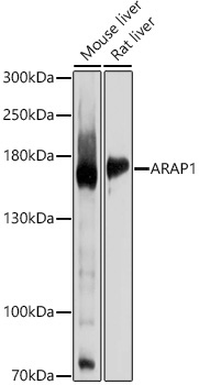 ARAP1 Rabbit Polyclonal Antibody