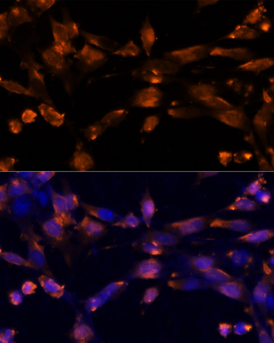 AREG Rabbit Polyclonal Antibody