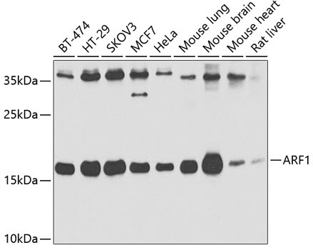 ARF1 Rabbit Polyclonal Antibody