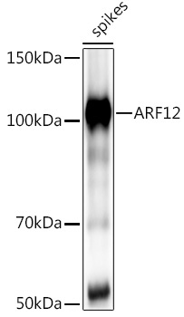 ARF12 Rabbit Polyclonal Antibody