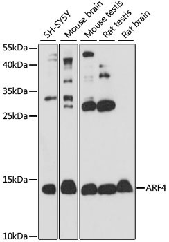 ARF4 Rabbit Polyclonal Antibody