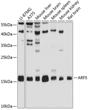 ARF5 Rabbit Polyclonal Antibody