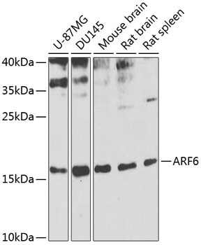 ARF6 Rabbit Polyclonal Antibody
