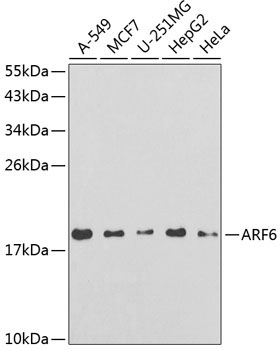 ARF6 Rabbit Polyclonal Antibody