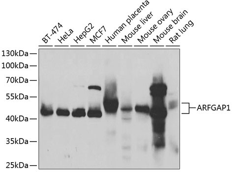 ARFGAP1 Rabbit Polyclonal Antibody