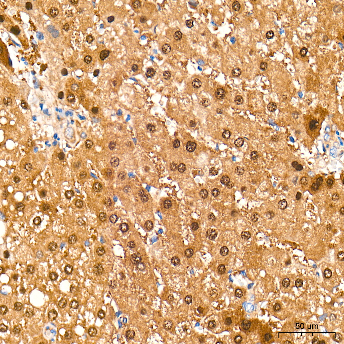 Arginase 1 (ARG1) Rabbit Polyclonal Antibody - Image 2