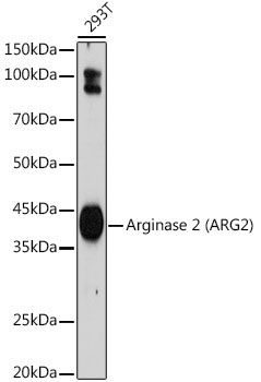 Arginase 2 (ARG2) Rabbit Monoclonal Antibody