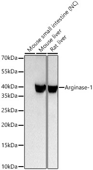Arginase-1 Rabbit Monoclonal Antibody