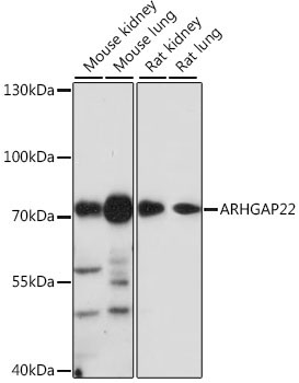 ARHGAP22 Rabbit Polyclonal Antibody