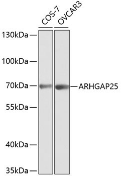 ARHGAP25 Rabbit Polyclonal Antibody