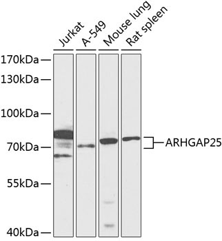 ARHGAP25 Rabbit Polyclonal Antibody