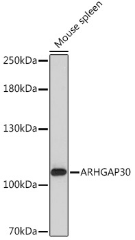 ARHGAP30 Rabbit Polyclonal Antibody