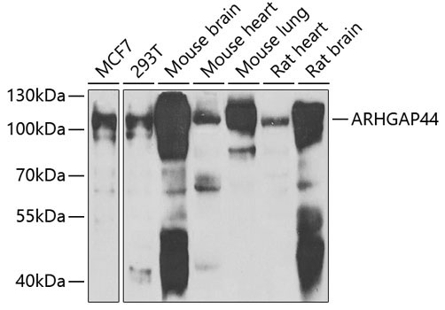 ARHGAP44 Rabbit Polyclonal Antibody