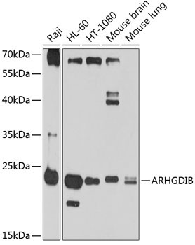 ARHGDIB Rabbit Polyclonal Antibody