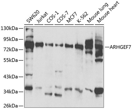 ARHGEF7 Rabbit Polyclonal Antibody