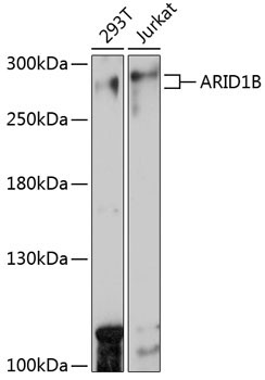 ARID1B Rabbit Polyclonal Antibody