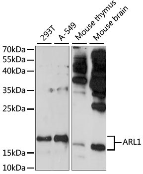 ARL1 Rabbit Polyclonal Antibody