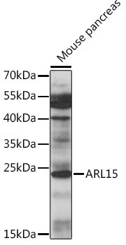 ARL15 Rabbit Polyclonal Antibody